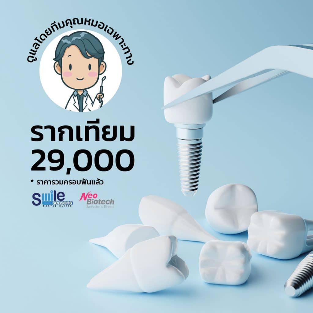 รากฟันเทียม 33 รากเทียม โปรโมชั่น 29,000 รวบครอบแล้ว