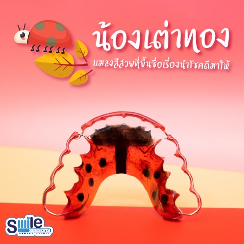 Retainer-LadyBug คลินิกทันตกรรม