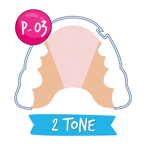 Retainer Pattern P-03