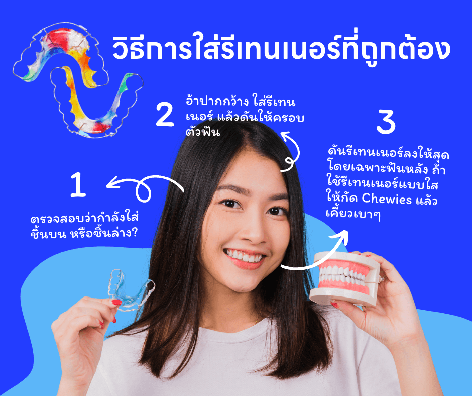 วิธีใส่รีเทนเนอร์