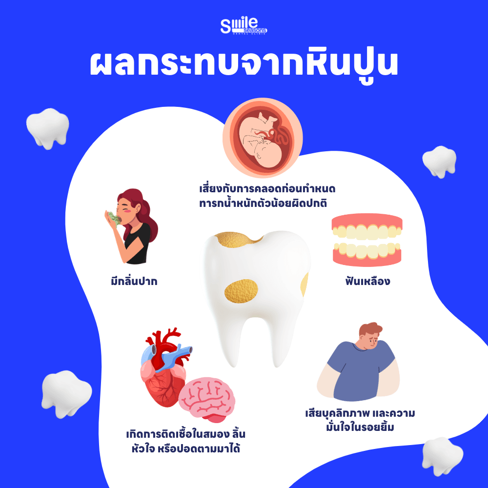 หินปูนส่งผลต่อเหงือกและฟันอย่างไร