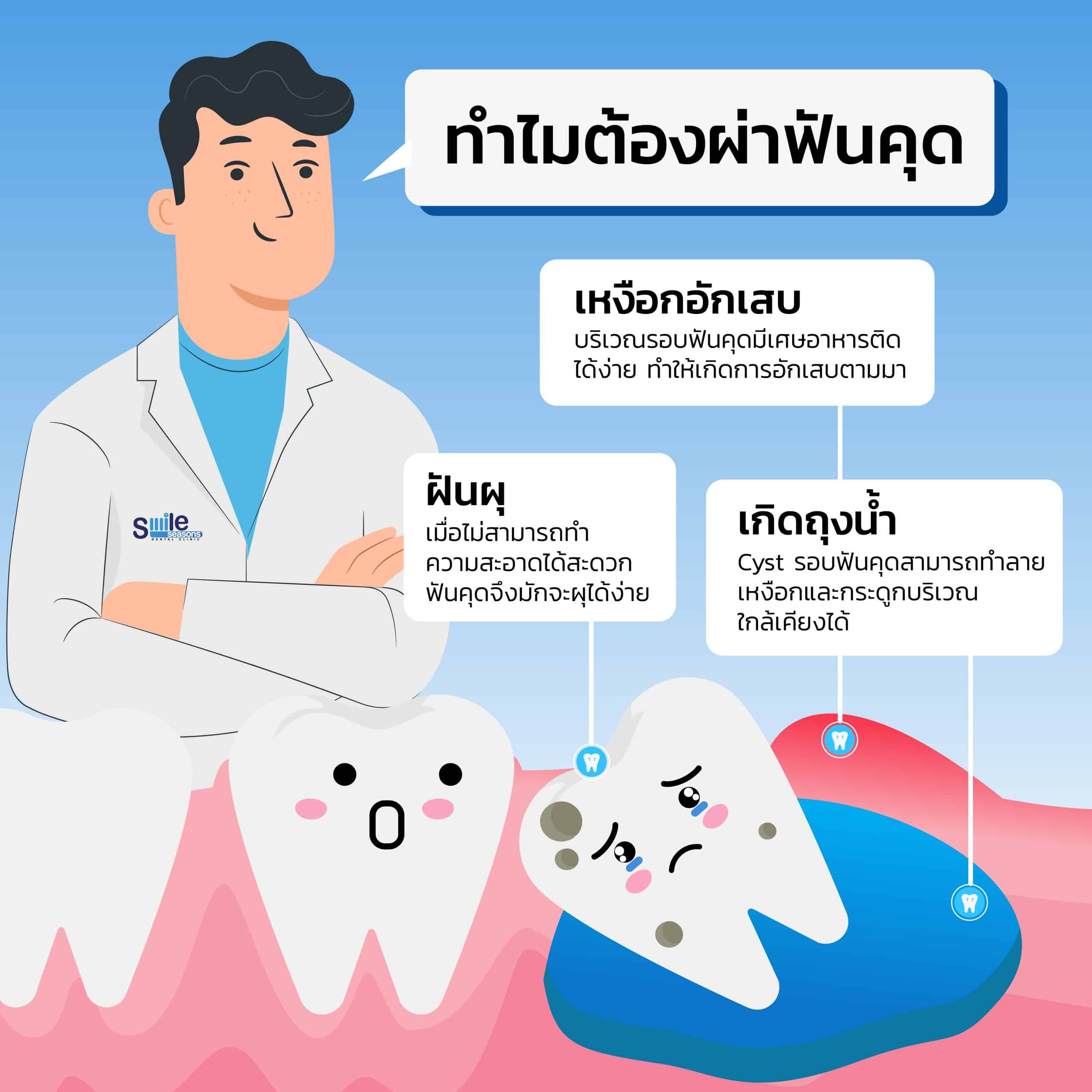 ถอนฟันคุดราคาเท่าไหร่