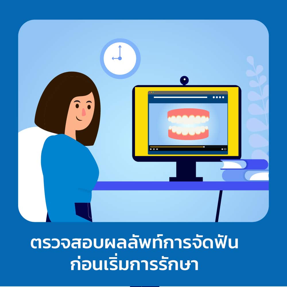 จัดฟันใส ดี-aligner ผลลัพธ์