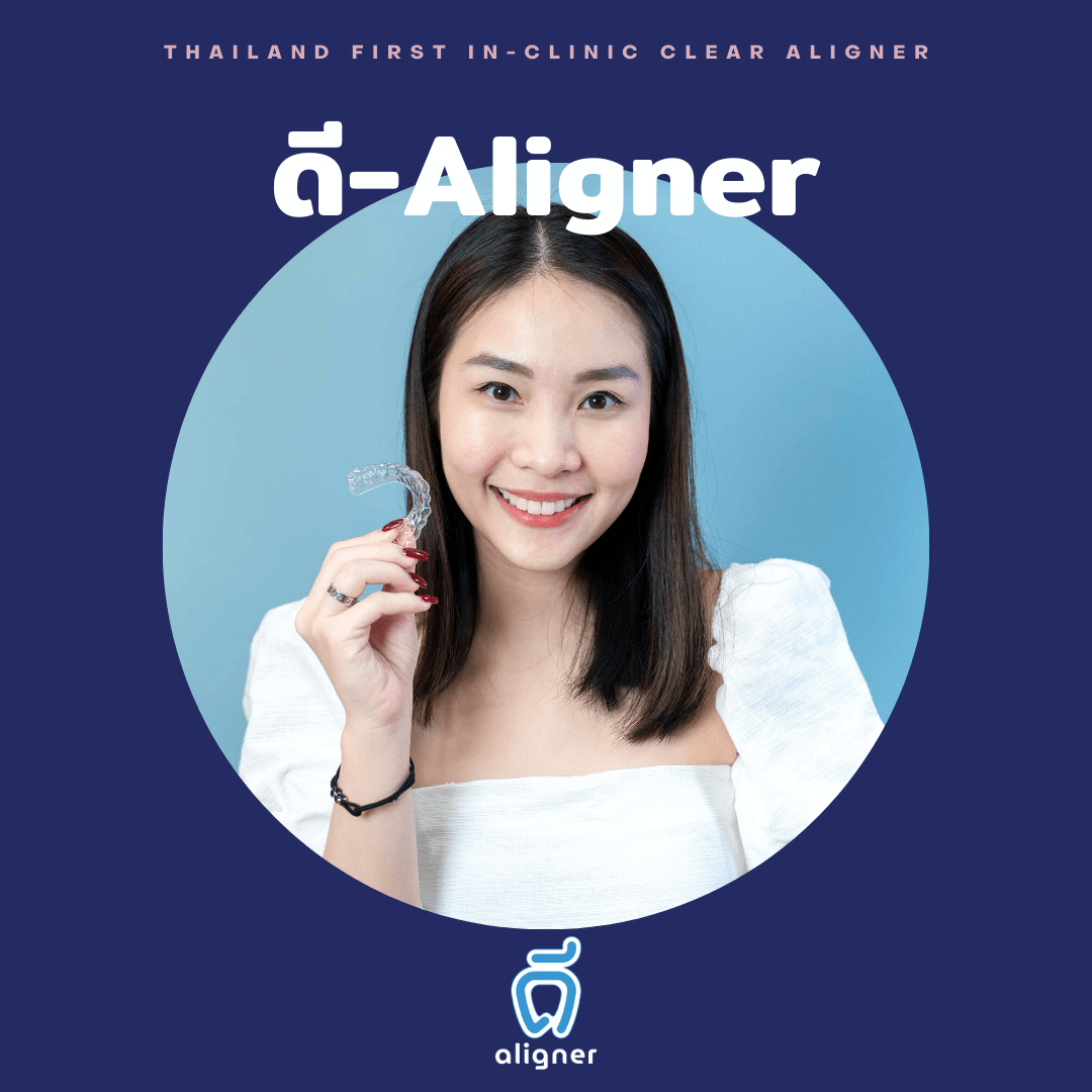 thumbnail ดี-aligner คุณเพ่ย