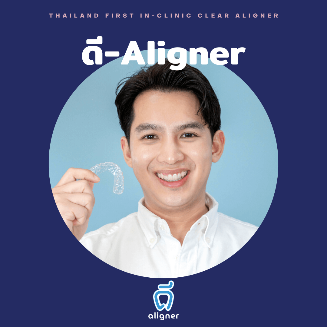 thumbnail ดี-aligner คุณพัธ