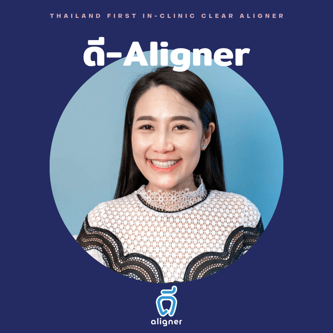 ดี-aligner รีวิว โย