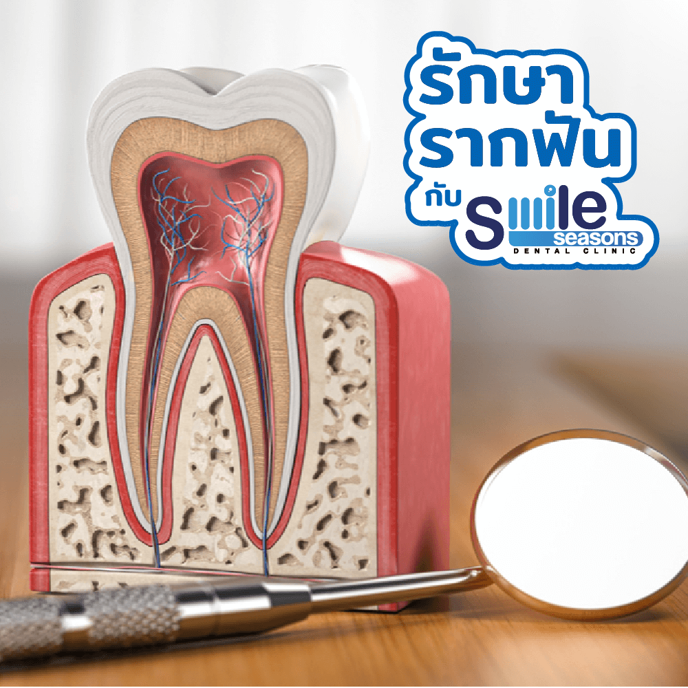 รักษารากฟันกับ Smile Seasons