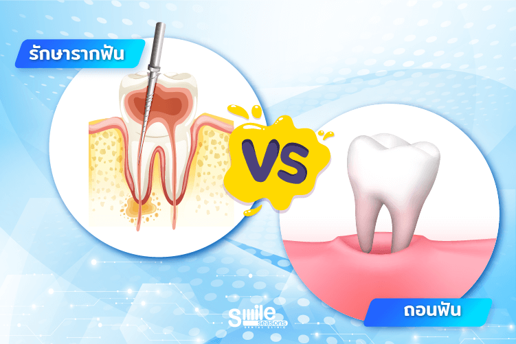 รักษาราก vs ถอนฟัน