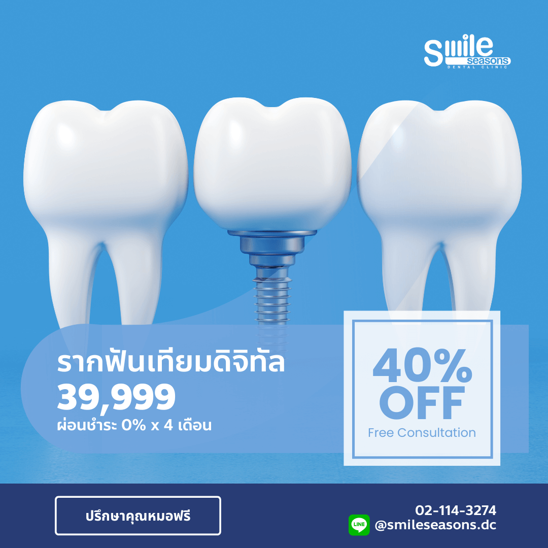 โปรโมชั่นรากฟันเทียม Dental Implant Surgery Promotion