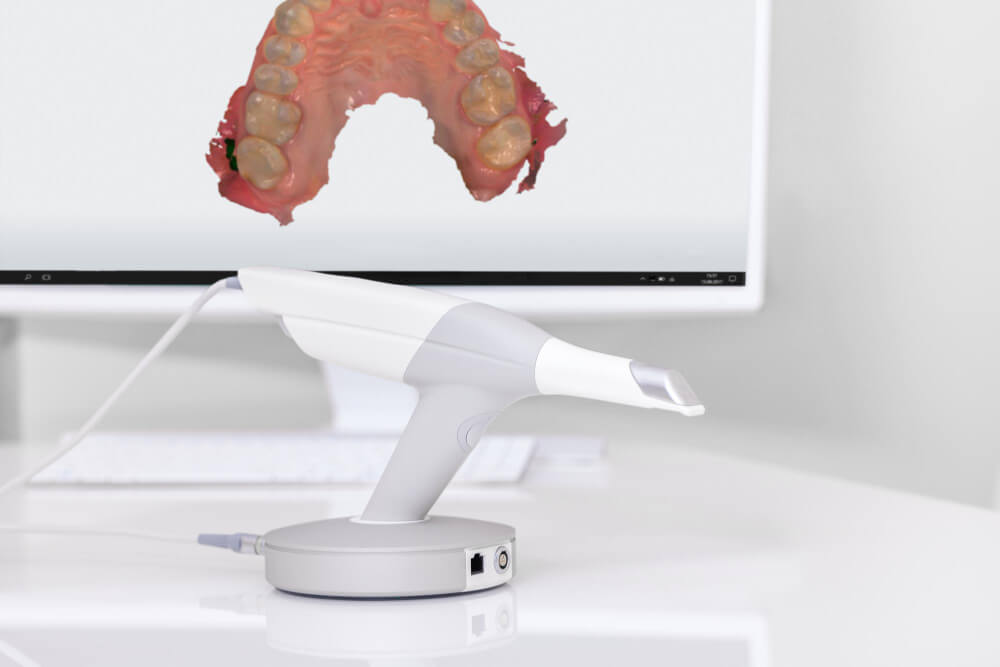 intra oral scanner