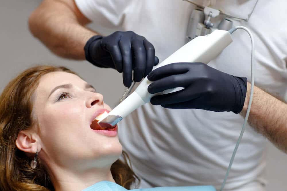 intra oral scanner