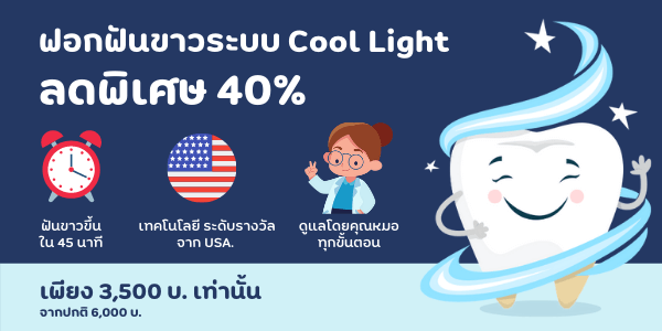 โปรโมชันฟอกสีฟัน Cool Light