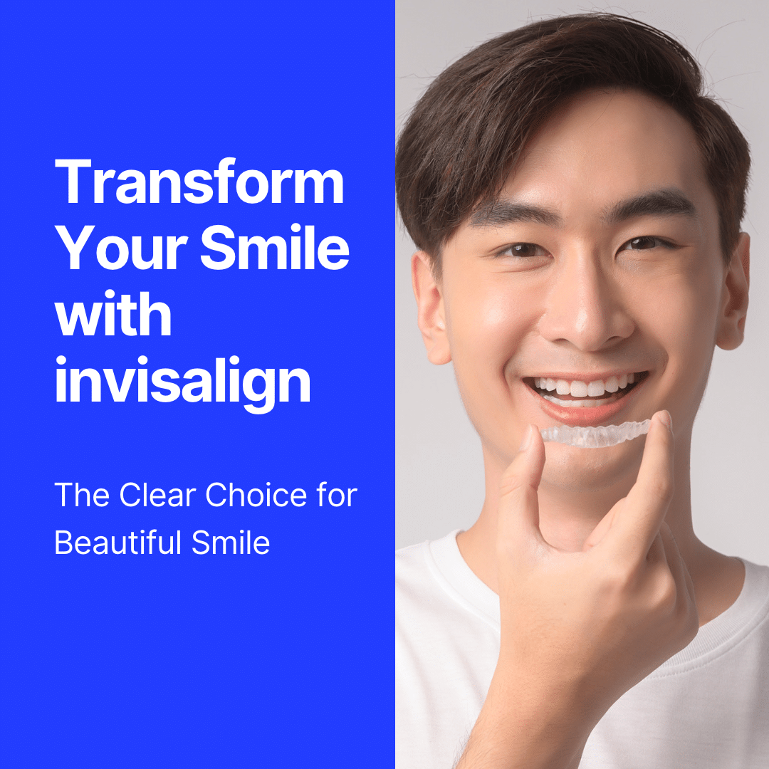 การจัดฟันแบบใส Invisalign