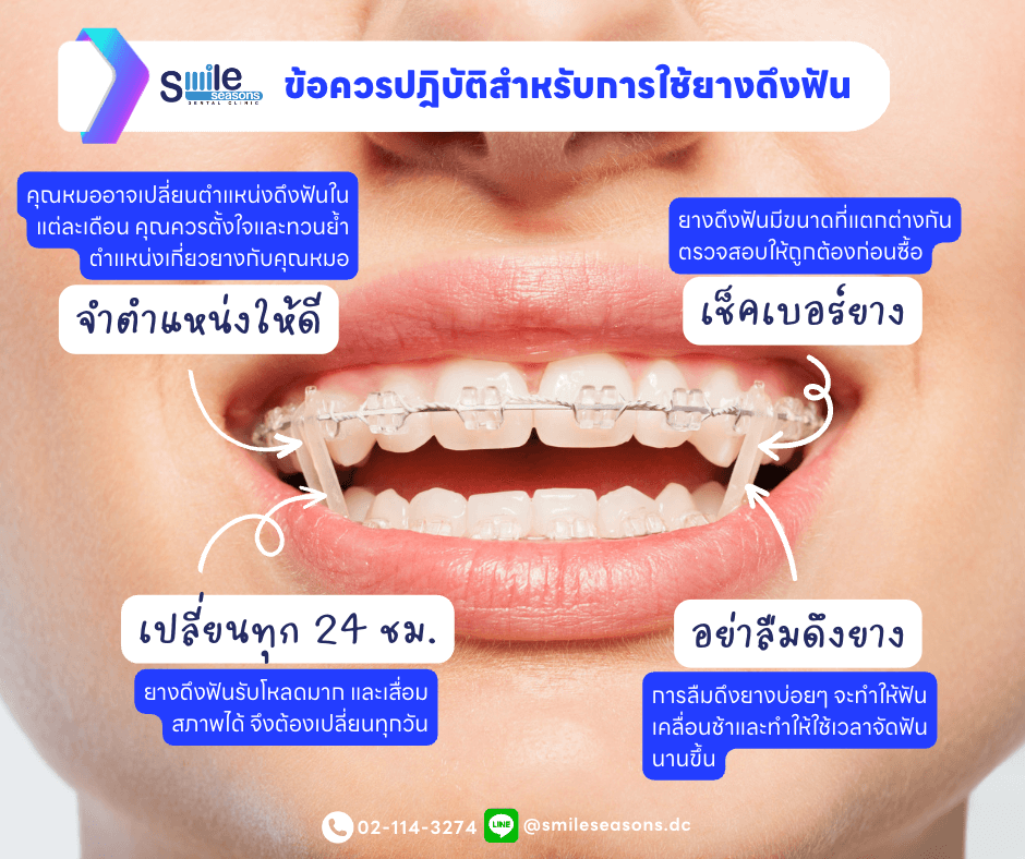 ข้อควรปฏิบัติสำหรับการใช้ยางดึงฟัน