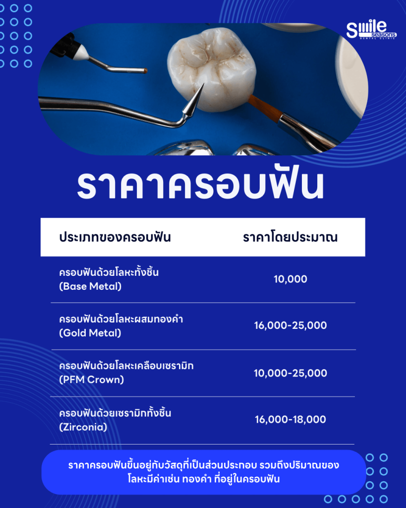 ครอบฟัน ราคา