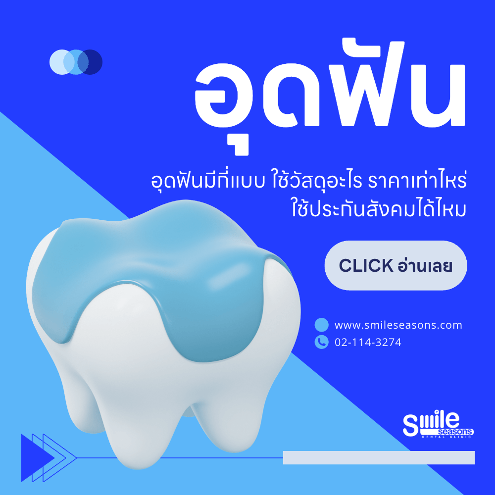 อุดฟัน - อุดฟันมีกี่แบบ ใช้วัสดุอะไร ราคาเท่าไหร่ ใช้ประกันสังคมได้ไหม