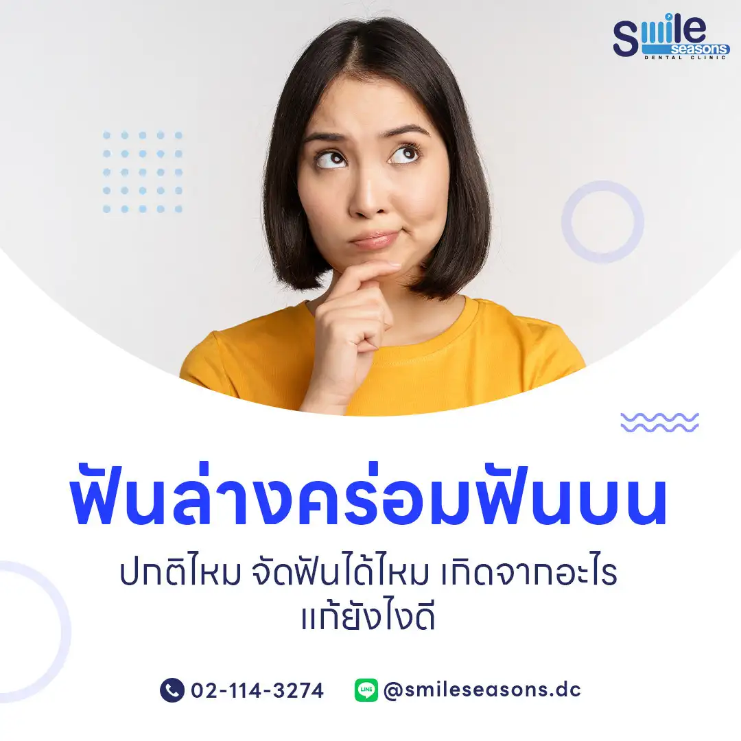 ฟันล่างคร่อมฟันบน หรือ Crossbite คือ ความผิดปกติในการสบฟันประเภทหนึ่ง