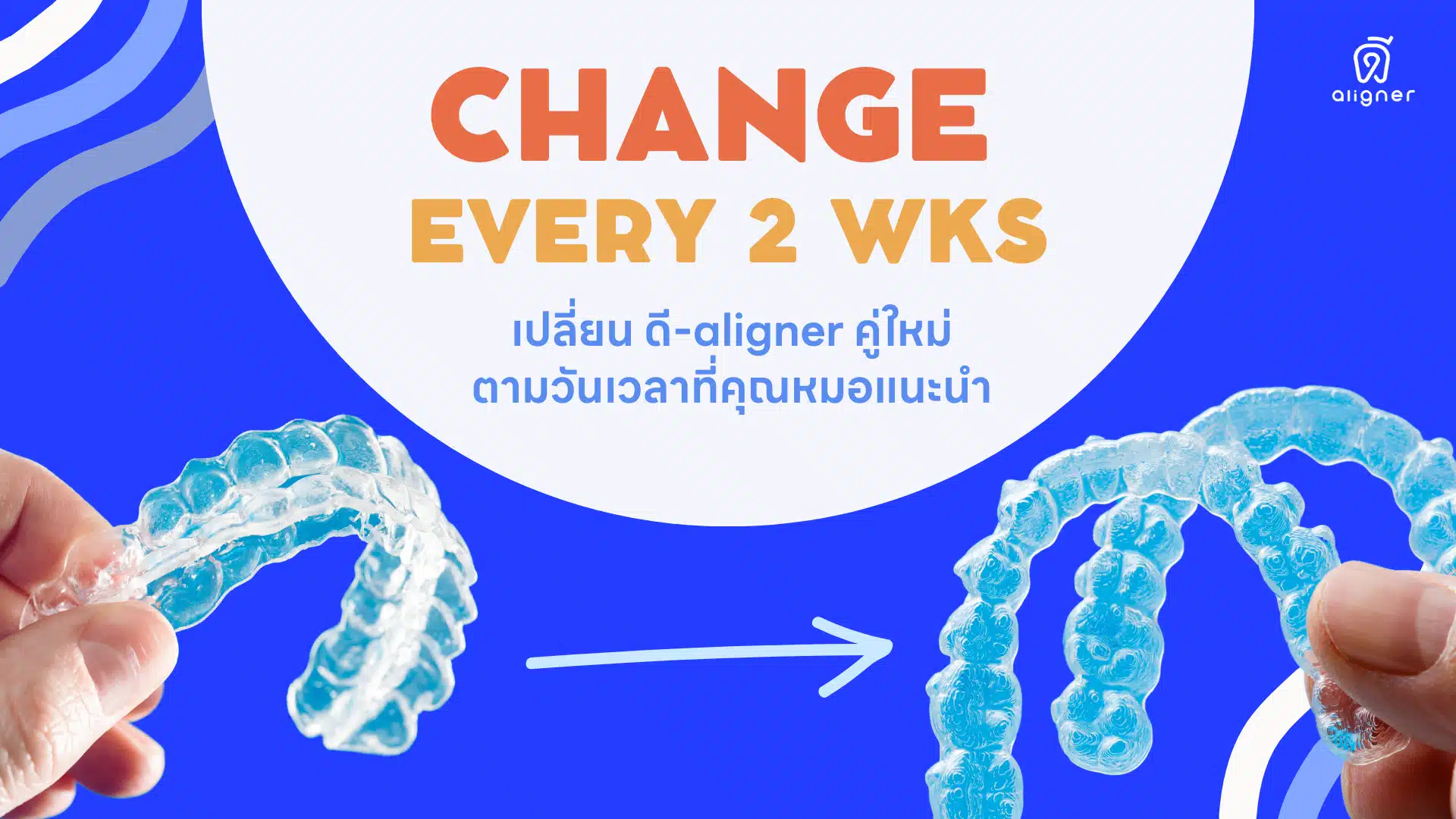 วิธีการปฎิบัติตัวหลังใส่ จัดฟันใส ดี-aligner - เปลี่ยนทุก 2 อาทิตย์