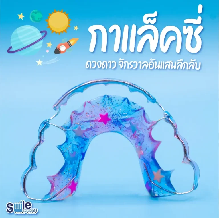 รีเทนเนอร์ ราคาเท่าไหร่ ดูราคารีเทนเนอร์ที่เหมาะกับคุณ