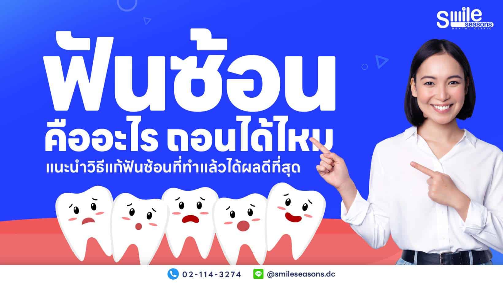 ฟันซ้อนคืออะไร ถอนได้ไหม แนะนำวิธีแก้ฟันซ้อนที่ทำแล้วได้ผลดีที่สุด