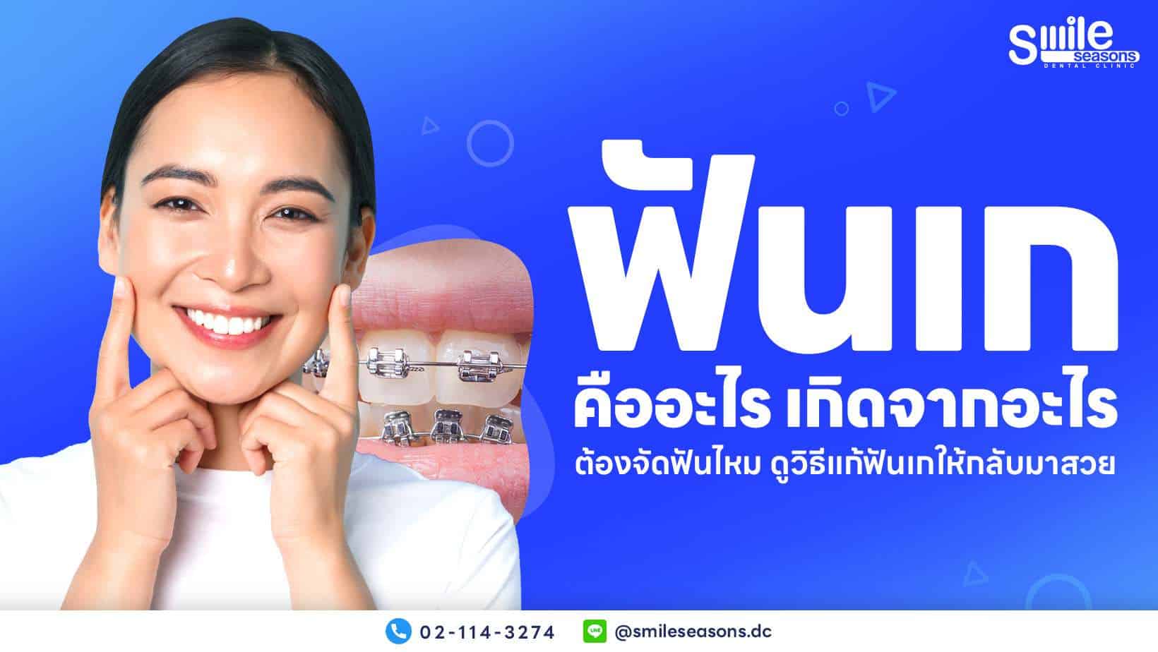 ฟันเกคืออะไร เกิดจากอะไร ต้องจัดฟันไหม ดูวิธีแก้ฟันเกให้กลับมาสวย