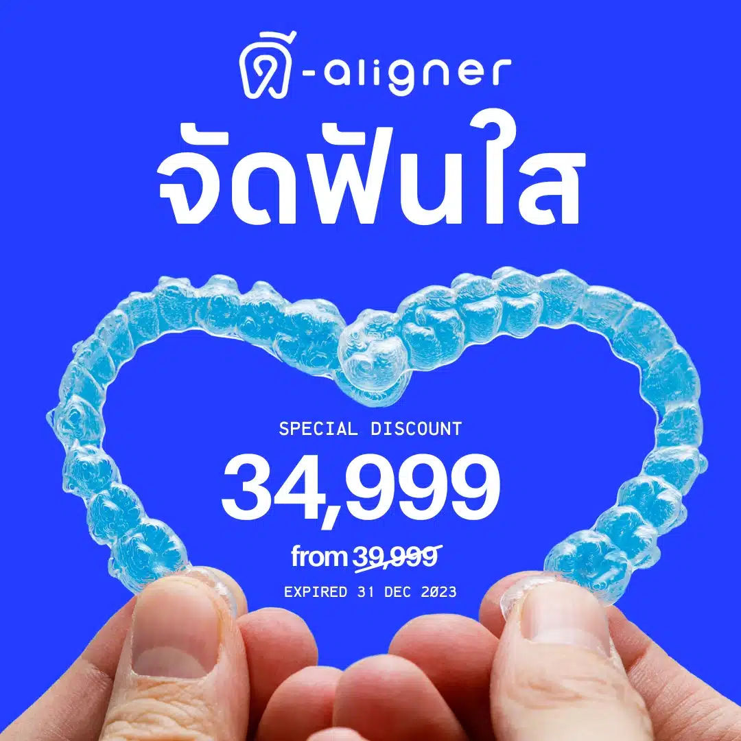 จัดฟันใส ดี-aligner 34,999