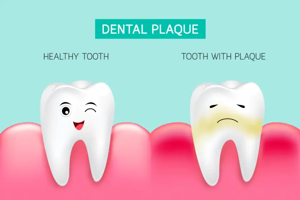 ฟันเป็นคราบนั้นเกิดขึ้นได้จากหลายสาเหตุ ซึ่งมีทั้งปัจจัยจากภายนอกฟัน และภายในเนื้อฟันเอง