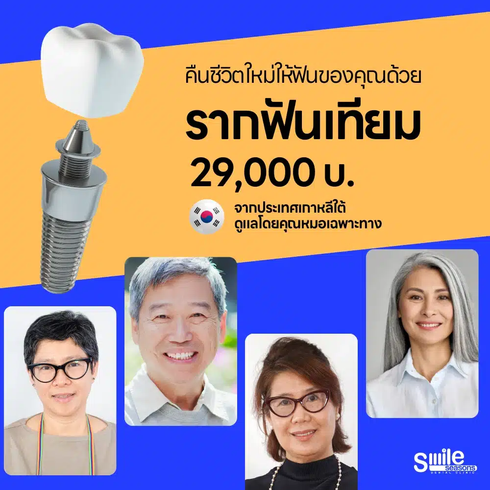 รากฟันเทียม 29,000