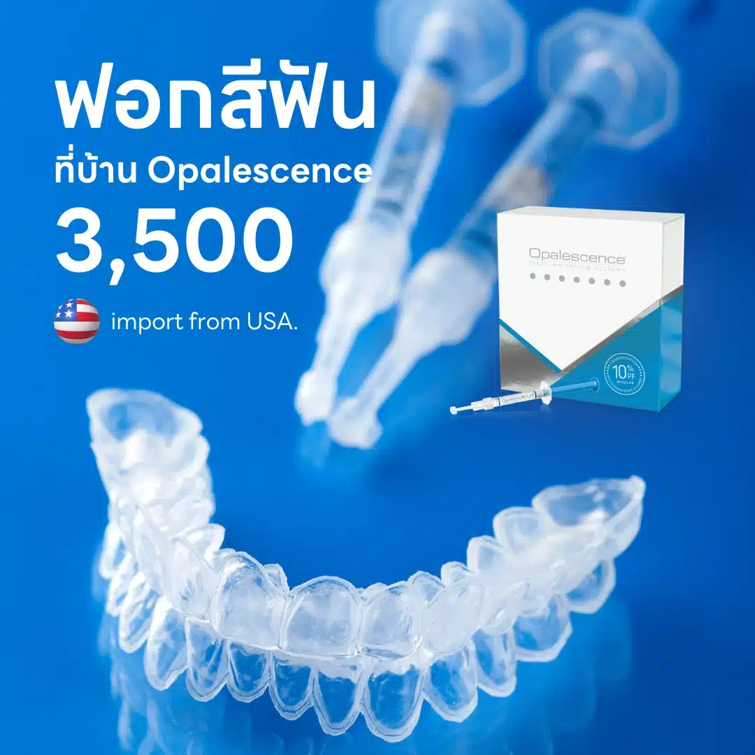 ฟอกสีฟันที่บ้าน HOME Opalescence