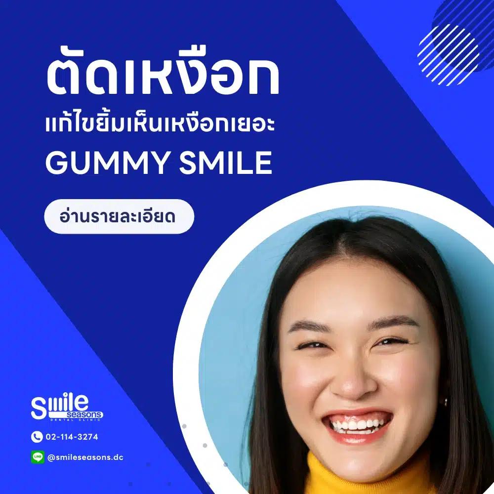 gummy smile esthetic crown lenght