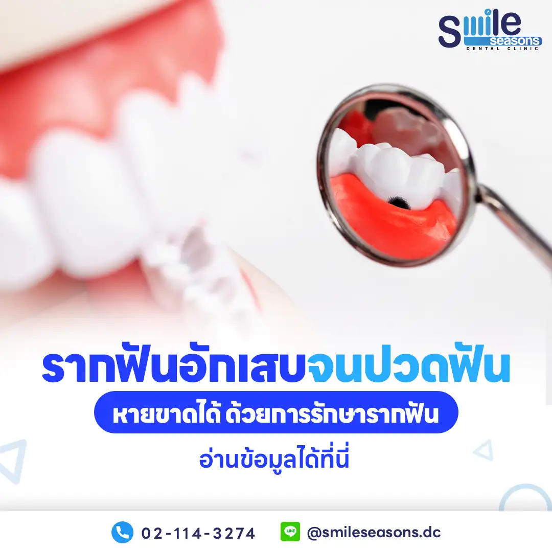 รากฟันอักเสบ เกิดจากการติดเชื้อที่เนื้อเยื่อภายในฟัน
