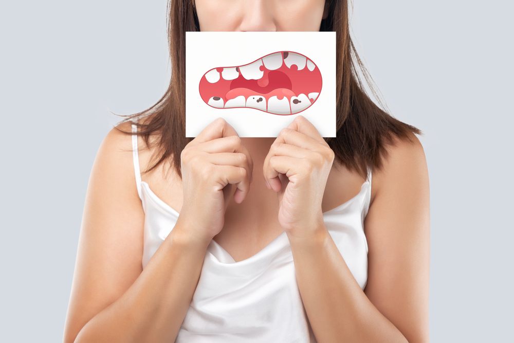 ฟันผุทะลุโพรงประสาท คืออะไร?