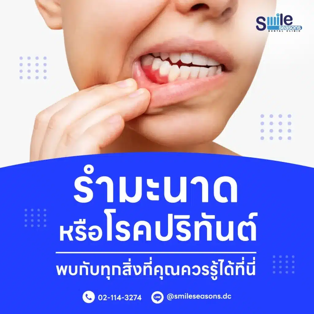 รำมะนาด