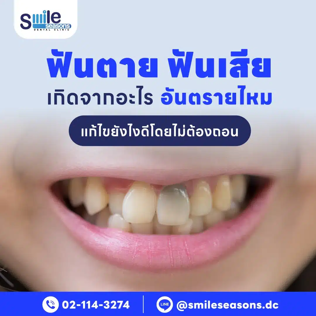 ฟันตาย
