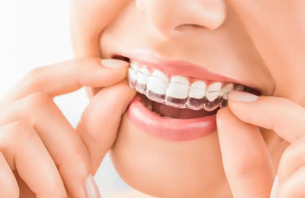 จัดฟันท่าพระ Smile Seasons