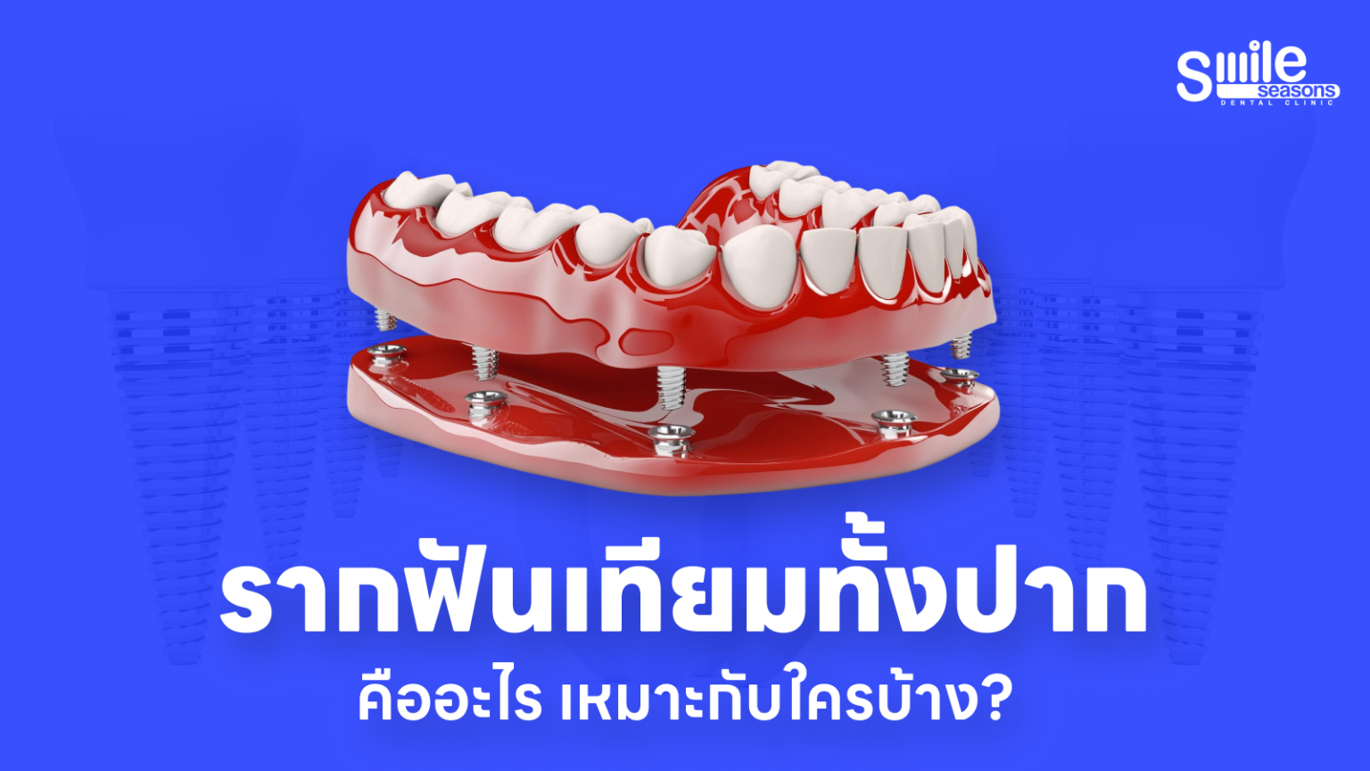 รากฟันเทียม All-on-4 โดยทันตแพทย์เฉพาะทาง