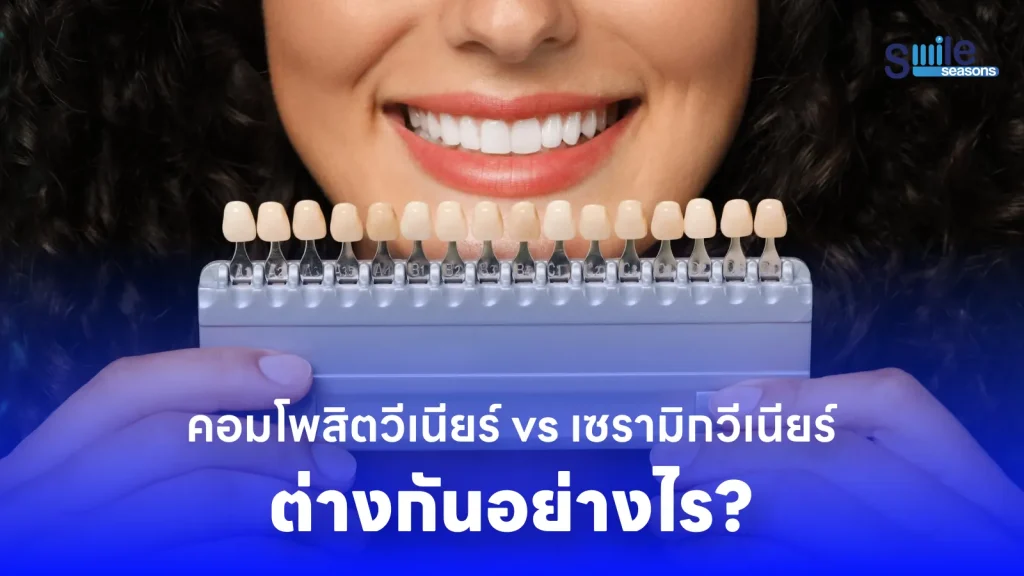 คอมโพสิตวีเนียร์ vs เซรามิกวีเนียร์ ต่างกันอย่างไร?