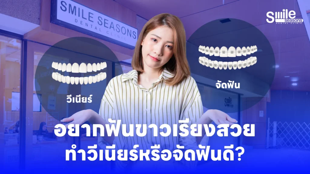 อยากฟันขาวเรียงสวย ทำวีเนียร์หรือจัดฟันดี?