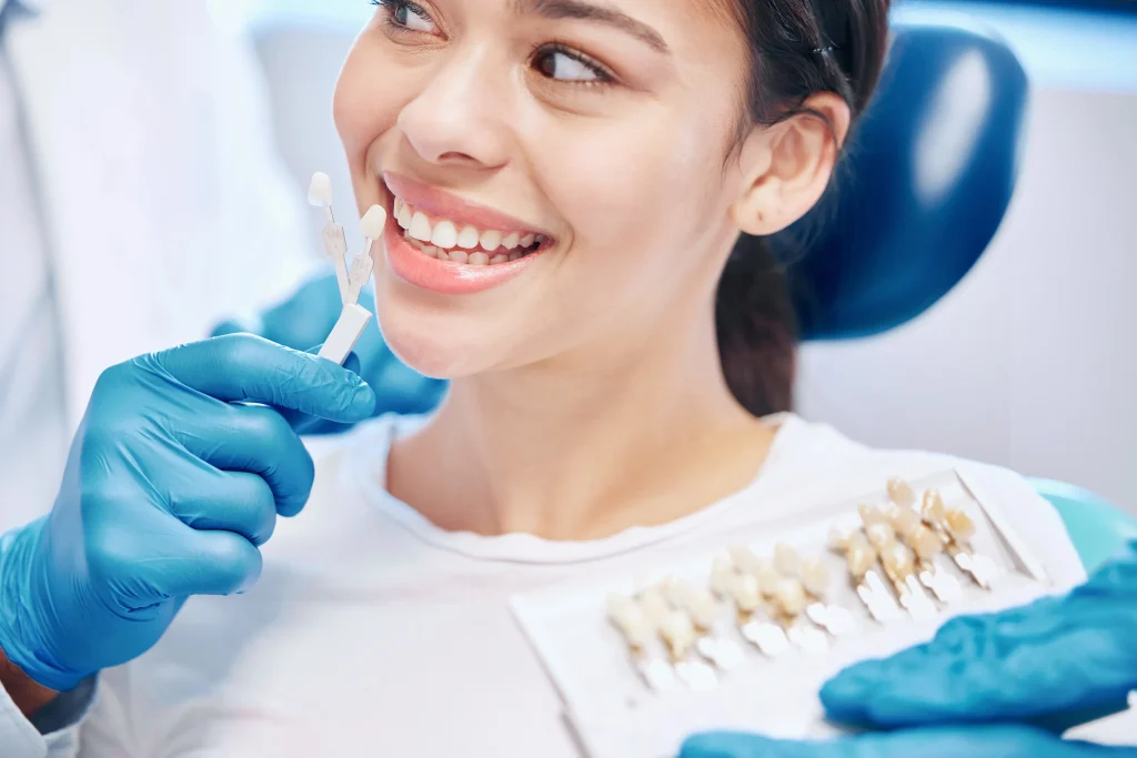 Veneers