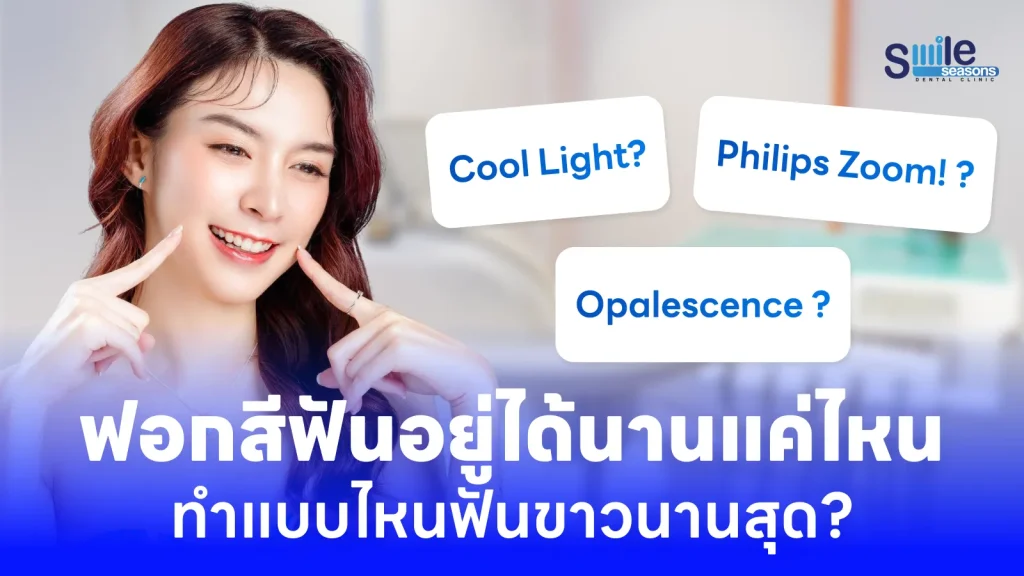 ฟอกสีฟันอยู่ได้นานแค่ไหน? แบบไหนอยู่นานสุด?
