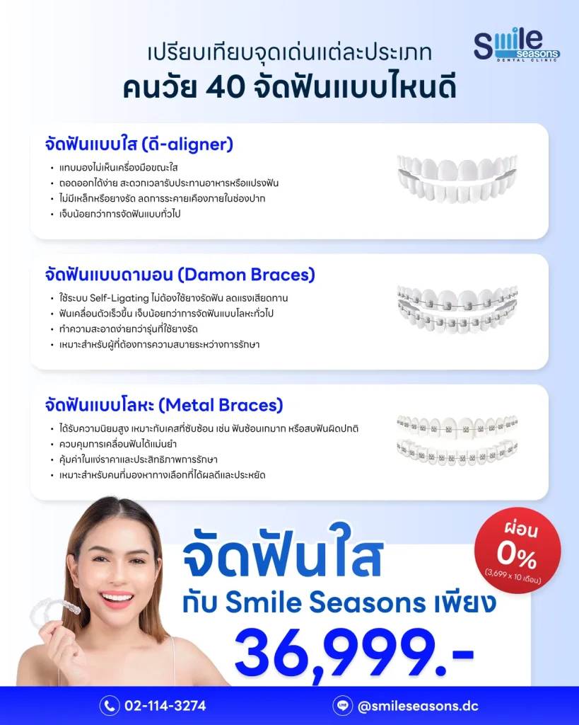 จัดฟันแบบไหนดี? สำหรับคนวัย 40