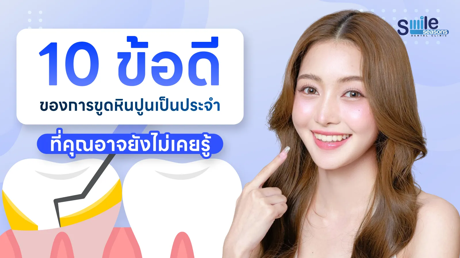 10 ข้อดีของการขูดหินปูนเป็นประจำ