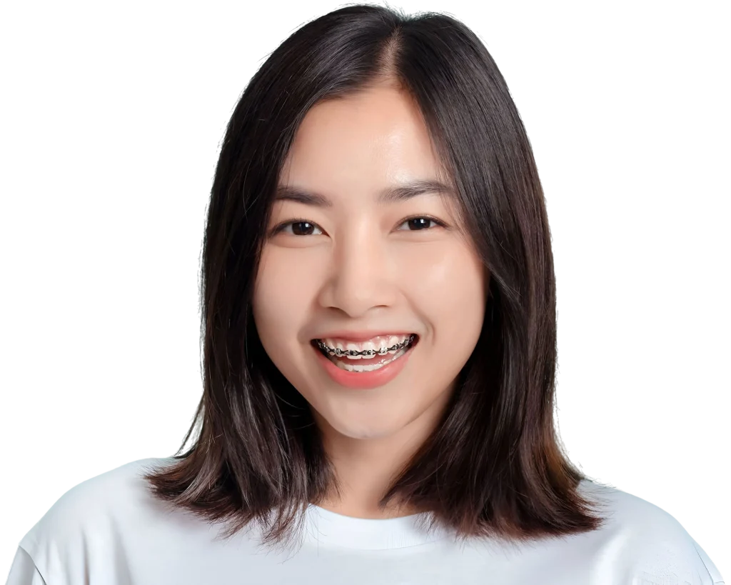 จัดฟันเหล็ก ยิ้มสวยมั่นใจทุกคอนเทนต์ ไม่ต้องหลบกล้องอีกต่อไป