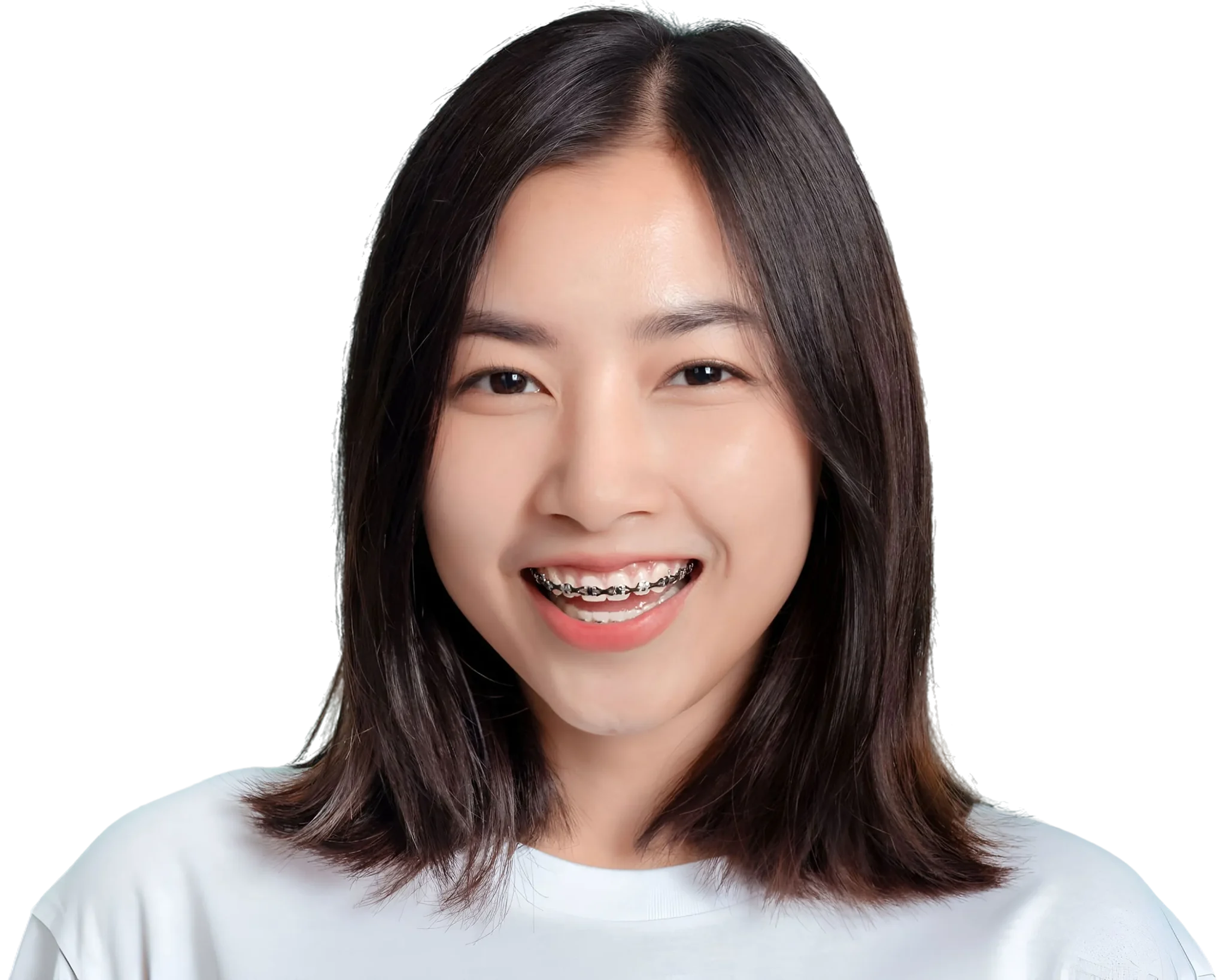 ผู้หญิงยิ้มสดใส โชว์เครื่องมือจัดฟันเหล็ก