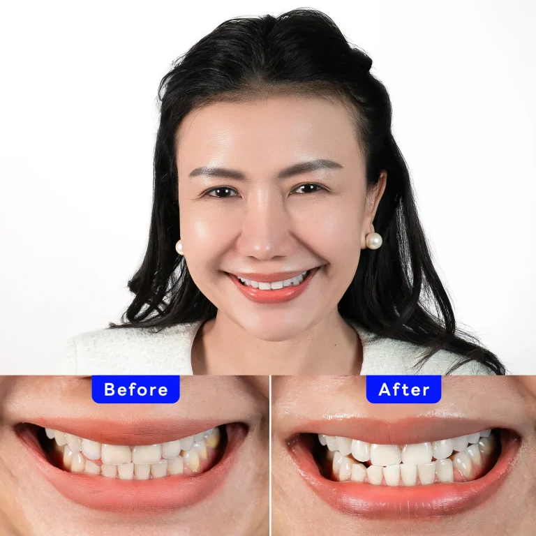 Zoom! Patient Case - Piyamas