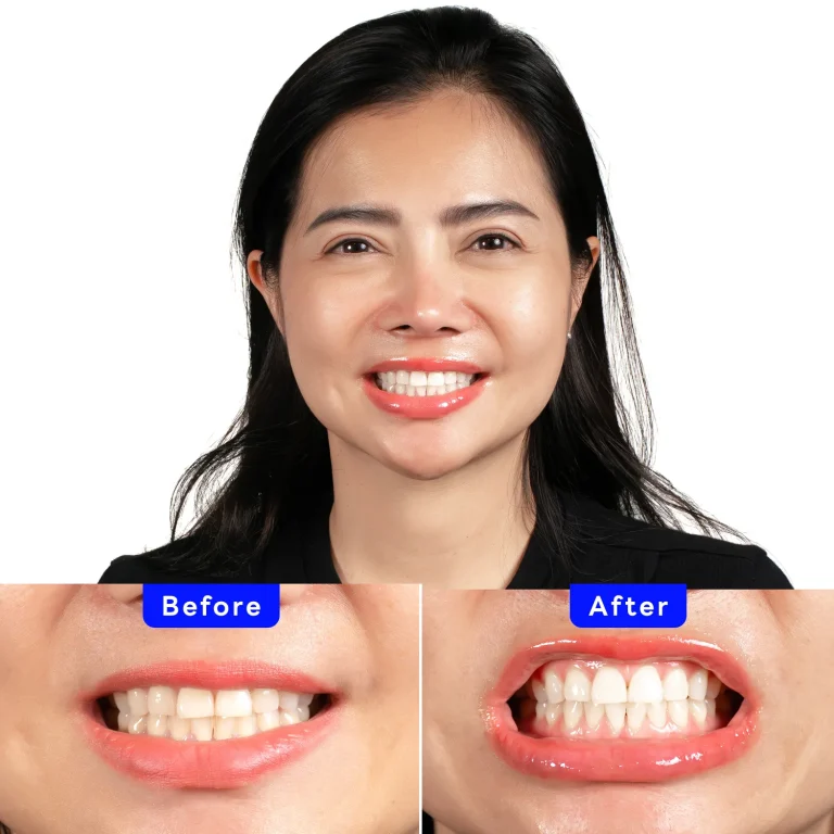 Zoom! Patient Case - Rosarin