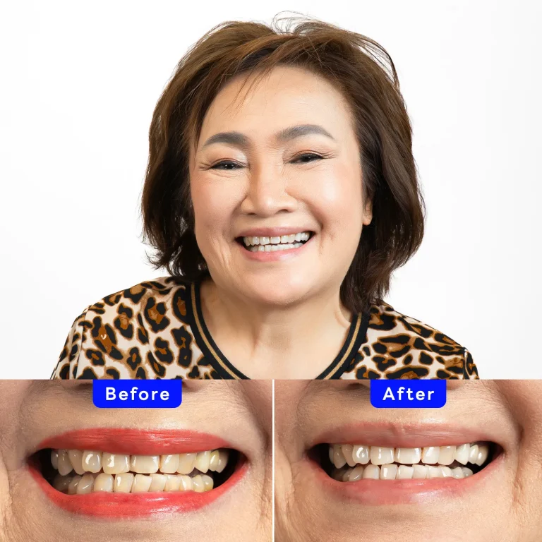 Zoom! Patient Case - Sarinna