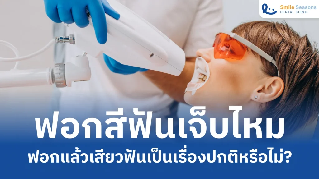 ฟอกสีฟันเจ็บไหม ฟอกแล้วเสียวฟันเป็นเรื่องปกติหรือไม่?