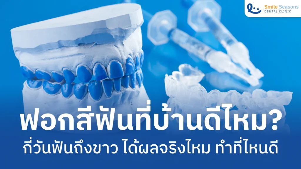 ฟอกสีฟันที่บ้านดีไหม? กี่วันฟันถึงขาว ได้ผลจริงไหม ทำที่ไหนดี