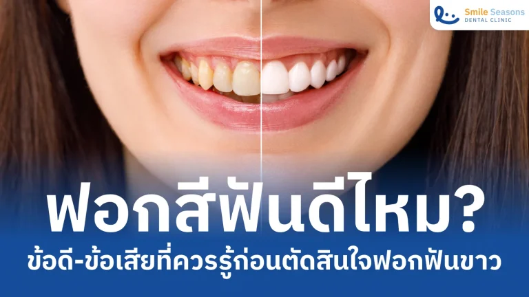 ฟอกสีฟันดีไหม? ข้อดีข้อเสียที่ควรรู้ก่อนตัดสินใจฟอกฟันขาว